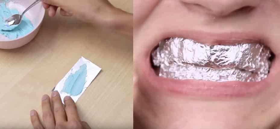 Clarear os dentes com folha de alumínio